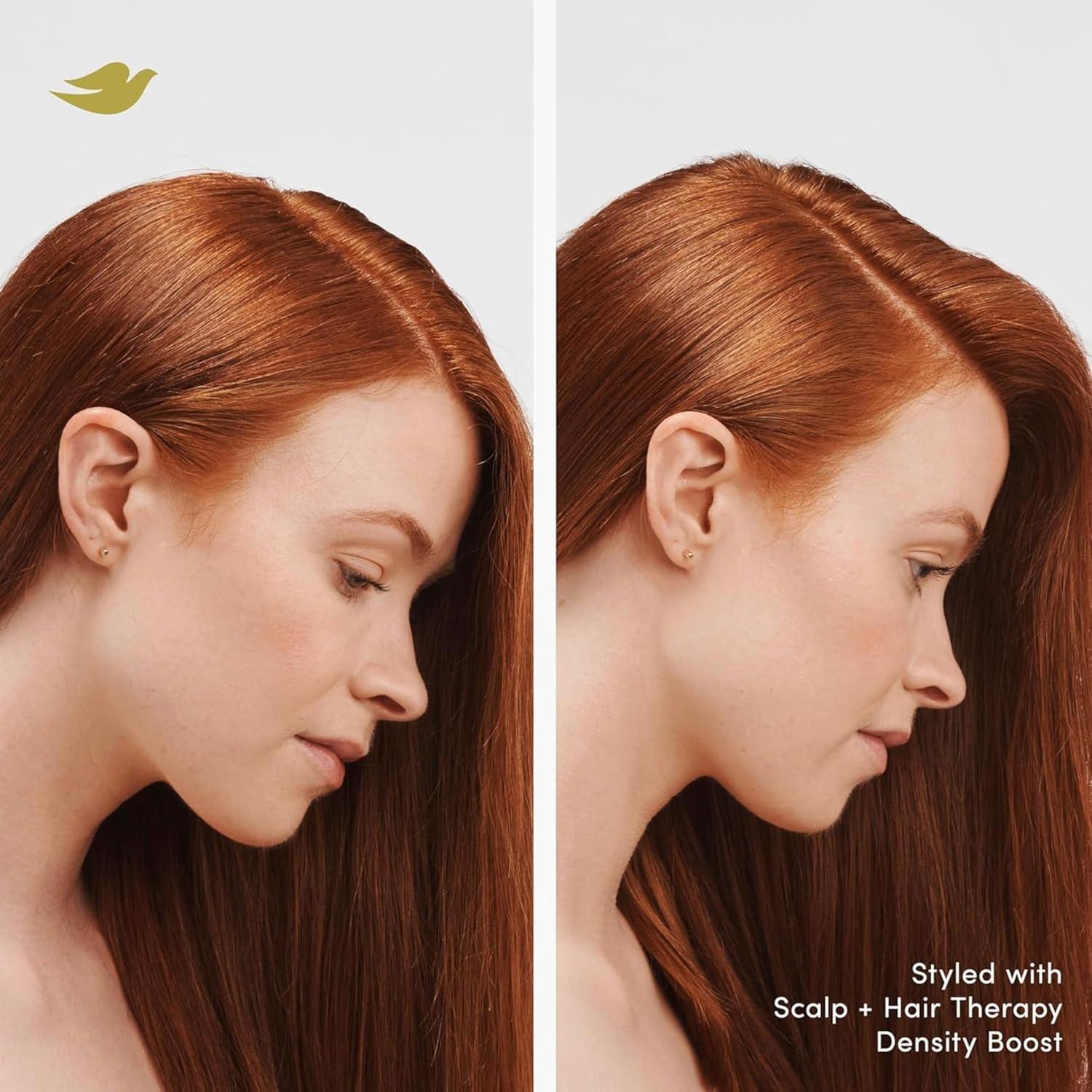 imageDove Density Boost Strengthening Conditioner Scalp Hair Therapy for protecting against premature breakage with Vitamin B3 Zinc and 0 sulfates 925 oz925 Fl Oz Pack of 2